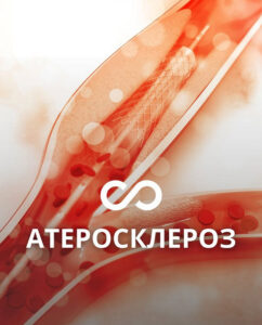 Атеросклероз сосудов ног