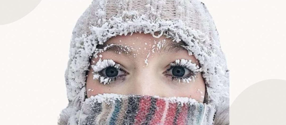 Что такое обморожение каз